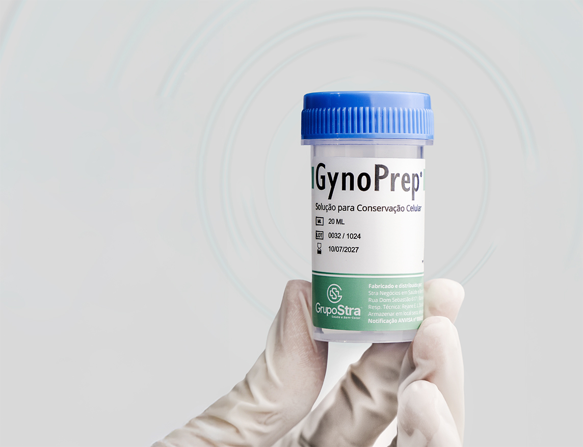 Imagem ilustrativa GynoPrep